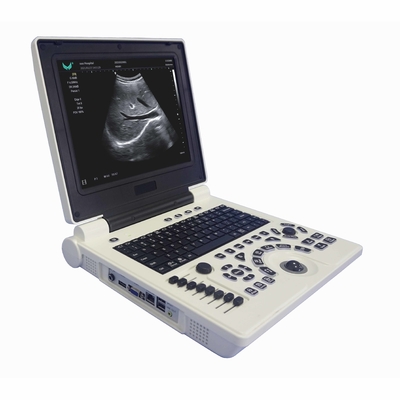 OB GYN Przenośna maszyna do ultrasonografii z kolorowym dopplerem w ciąży