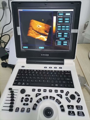 Xianfeng Ciąża Color Doppler Ultrasonografy Obrazy 4B OEM