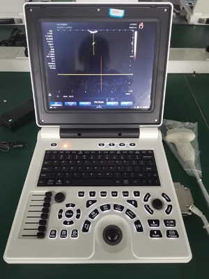 DICOM Przenośna maszyna ultradźwiękowa 3D Doppler Instrument medyczny 64G