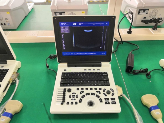 12,1 cala Tech Diagnostic Ultrasound Scanner Maszyna Li Battery