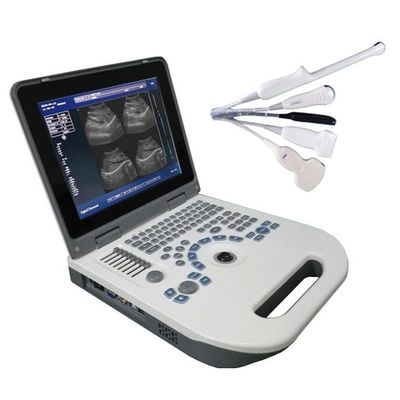 Jakość  TGC Control Notebook Ultrasound Scanner For Pregnancy Home Use fabryka