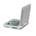 15-calowy przenośny kolorowy ultrasonograf LED z kątem skanowania 60 stopni i głębokością wyświetlania ≥250 mm