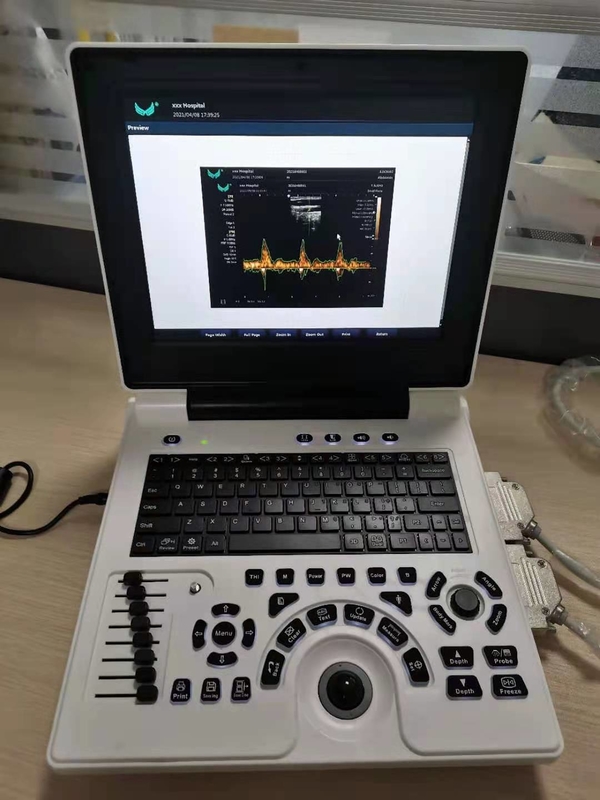 Xianfeng Ciąża Color Doppler Ultrasonografy Obrazy 4B OEM