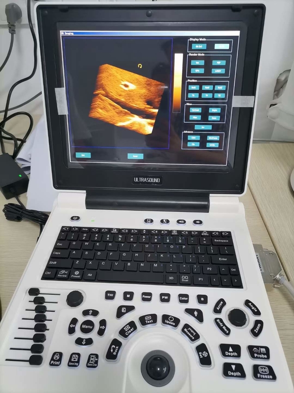 Xianfeng Ciąża Color Doppler Ultrasonografy Obrazy 4B OEM