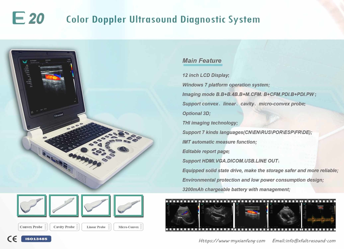 Win7 System Przenośny kolorowy skaner ultradźwiękowy Doppler Bateria 3200 mAh