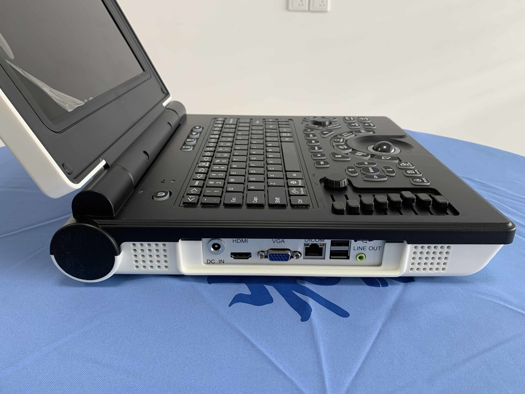 Win7 System Przenośny kolorowy skaner ultradźwiękowy Doppler Bateria 3200 mAh