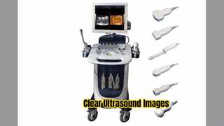 Ultrasonograf Dopplera PW CFM Tryb PDI