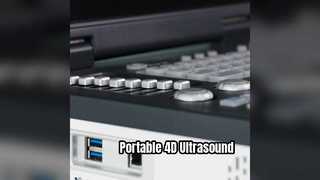Przenośny aparat USG Doppler 4D, gotowy na oddział intensywnej terapii