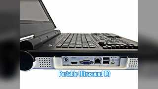 Przenośne badanie urologiczne E0 z kolorowym dopplerem